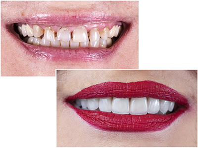 Cosmetic Dentistry